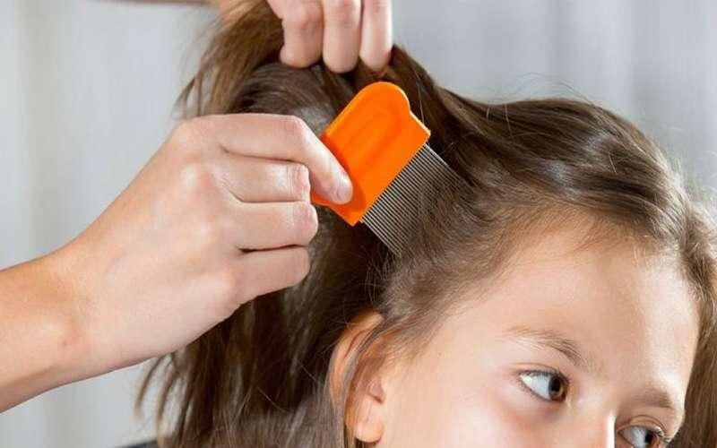 راهکار خلاصی کودک از شپش را بشناسید